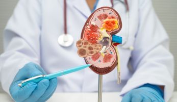 Kidney & Ureteral Stone Disease