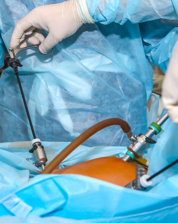 Laparoscopic Urologic Surgery (1)