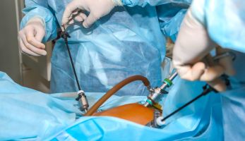 Laparoscopic Urologic Surgery