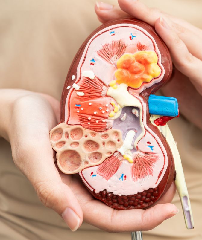 Renal Cancer Treatment (1)